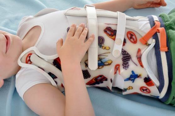 Non-Surgical Scoliosis Treatments