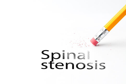 Spinal Stenosis in Los Angeles, CA