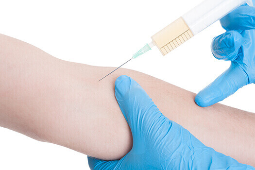 Joint Injections Information in Los Angeles, CA