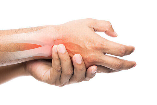 Paget's Disease Overview