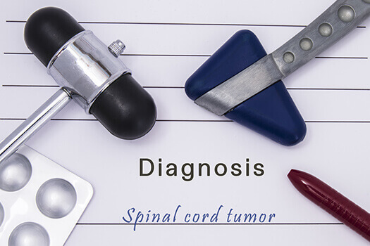 Spinal Cord Tumor