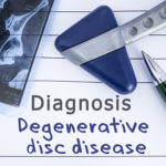Preventing Degenerative Disc Disease from Getting Worse