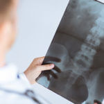 Ailments Spinal Surgery Can & Cannot Fix