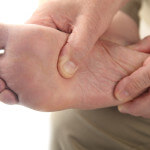How Do Foot Arches Lead to Back Pain?