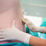 How Are Spinal & Epidural Anesthesia Different?