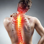 Treating Spinal Bone Bruises
