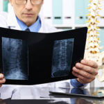 How to Tell When You Need Spinal Surgery