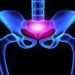 How to Ease Pain in Your Sacroiliac Joint