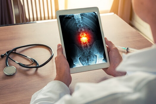 Common Imaging Tests for Spine Los Angeles, CA
