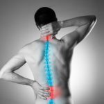 What You Should Know About Spinal Myelography