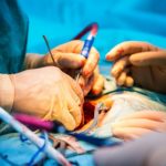 6 Commonly Used Surgical Procedures for Spinal Decompression