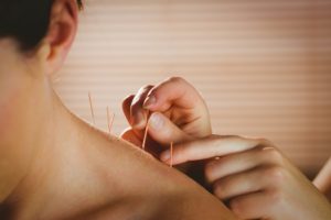 How Does Acupuncture Provide Effective Relief from Neck Pain in Los Angeles, CA