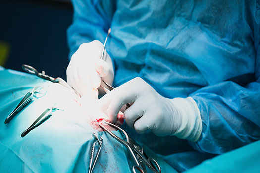Precautions To Take When Preparing for Back Surgery in Los Angeles, CA