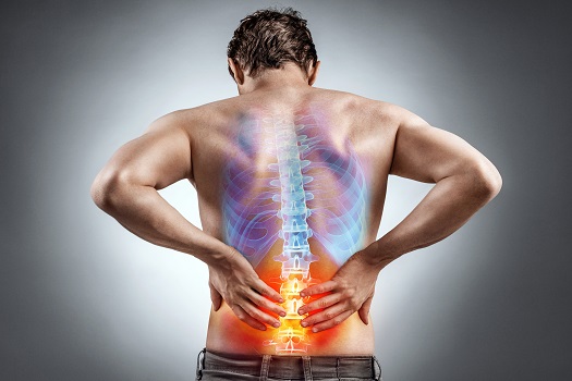 How do i Know if My Pain Is Sciatica or Another Issue in Los Angeles, CA