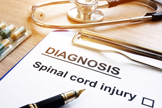 Symptoms, Diagnosis, & Treatment Of Spinal Cord Cysts in Los Angeles, CA
