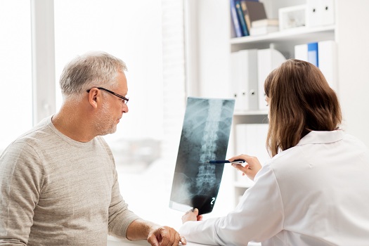 How to Prepare for Spine Surgery that Has Been Delayed by COVID-19 in Los Angeles, CA