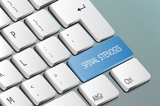 How Can Spinal Stenosis Be Prevented in Los Angeles, CA